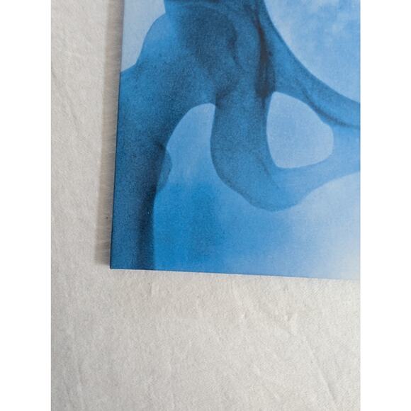 Lorde Signed Vinyl Virgin LP Autographed X-Ray Picture Disc - Picture 14 of 16